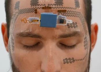 Një tatuazh hi-tech në fytyre për të monitoruar stresin: revolucion apo çmenduri?