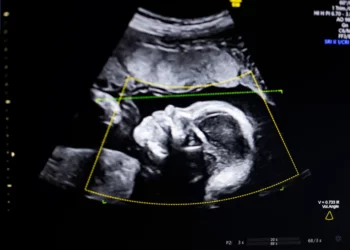 Ultratingulli fetal me AI merr miratimin e FDA-së, BioticsAI hap një kapitull të ri