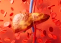 AI mund të zbulojë shenjat e kancerit të mëlçisë shumë më përpara diagnozës