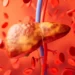AI mund të zbulojë shenjat e kancerit të mëlçisë shumë më përpara diagnozës